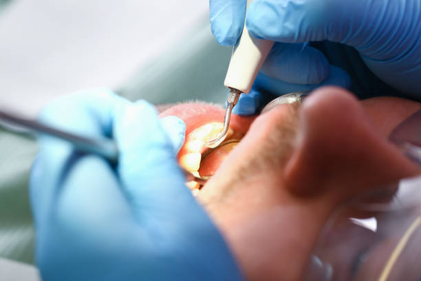 Best After-Hours Emergency Dentist in Shreve, OH