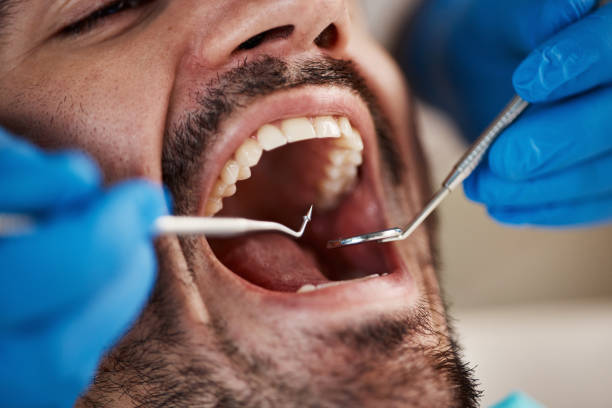 Best Emergency Broken Tooth Repair in Shreve, OH